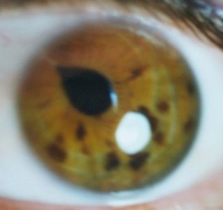 El diagnóstico de la pupila en Iridología