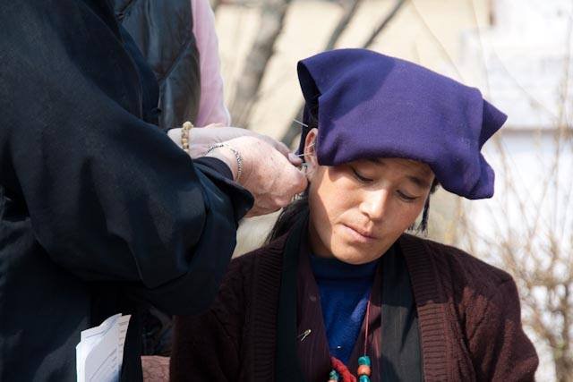 Embajadores de acupuntura Misión a Nepal de octubre 2015