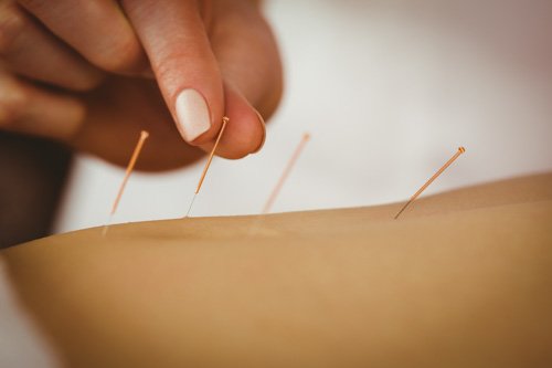 La acupuntura y algunas hierbas solucionan la enfermedad de inflamacion pélvica (EIP)