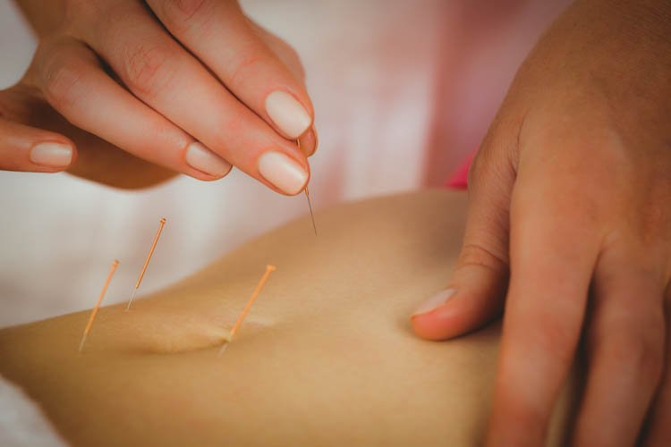 La acupuntura  tratamiento eficaz de la enfermedad inflamatoria pelvica